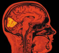 bscn_img3